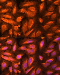 Invitrogen DTYMK Polyclonal Antibody 100 &mu;L; Unconjugated:Antibodies,