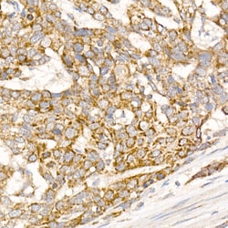 Invitrogen Glycerol kinase Polyclonal Antibody 100 &mu;L; Unconjugated:Antibodies,
