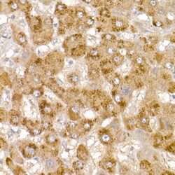 Invitrogen Glycerol kinase Polyclonal Antibody 100 &mu;L; Unconjugated:Antibodies,