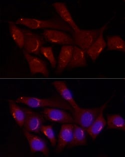 Invitrogen GRP Polyclonal Antibody 100 &mu;L; Unconjugated:Antibodies,
