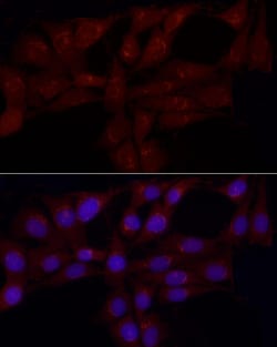 Invitrogen GRP Polyclonal Antibody 100 &mu;L; Unconjugated:Antibodies,