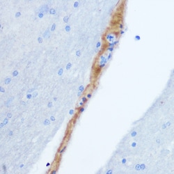 Invitrogen GRP Polyclonal Antibody 100 &mu;L; Unconjugated:Antibodies,