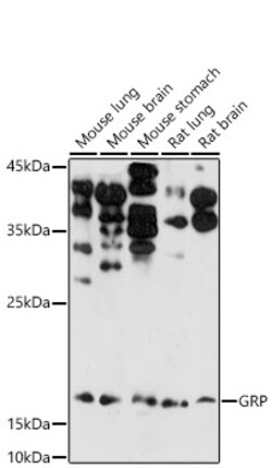 Invitrogen GRP Polyclonal Antibody 100 &mu;L; Unconjugated:Antibodies,