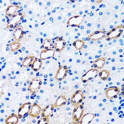 Invitrogen IMPA1 Polyclonal Antibody 100 &mu;L; Unconjugated:Antibodies,
