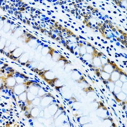 Invitrogen IMPA1 Polyclonal Antibody 100 &mu;L; Unconjugated:Antibodies,