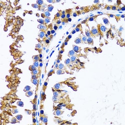 Invitrogen IMPA1 Polyclonal Antibody 100 &mu;L; Unconjugated:Antibodies,
