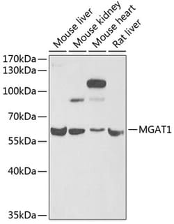 Invitrogen MGAT1 Polyclonal Antibody 100 &mu;L; Unconjugated:Antibodies,