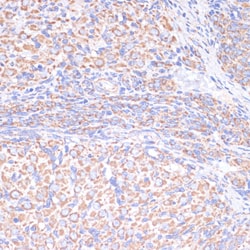 Invitrogen COX5A Polyclonal Antibody 100 &mu;L; Unconjugated:Antibodies,