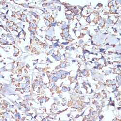 Invitrogen COX5A Polyclonal Antibody 100 &mu;L; Unconjugated:Antibodies,