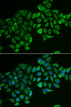 Invitrogen RhoD Polyclonal Antibody 100 &mu;L; Unconjugated:Antibodies,