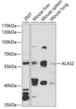 Invitrogen ALAS2 Polyclonal Antibody 100 &mu;L; Unconjugated:Antibodies,