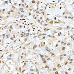 Invitrogen BAP1 Polyclonal Antibody 100 μL; Unconjugated:Antibodies,