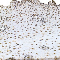 Invitrogen BAP1 Polyclonal Antibody 100 μL; Unconjugated:Antibodies,