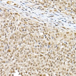 Invitrogen BAP1 Polyclonal Antibody 100 μL; Unconjugated:Antibodies,