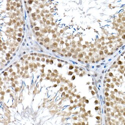Invitrogen BAP1 Polyclonal Antibody 100 μL; Unconjugated:Antibodies,