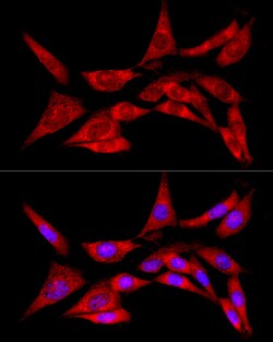 Invitrogen LZIP Polyclonal Antibody 100 μL; Unconjugated:Antibodies,
