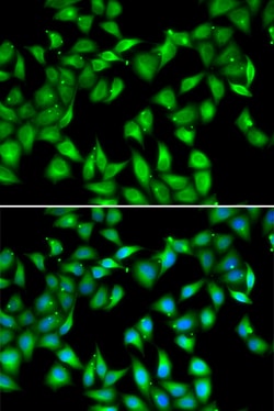 Invitrogen MYL3 Polyclonal Antibody 100 &mu;L; Unconjugated:Antibodies,