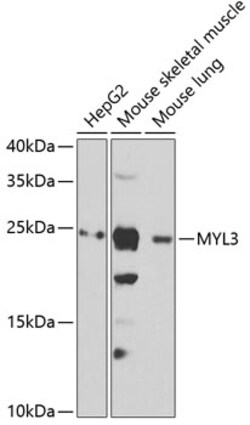 Invitrogen MYL3 Polyclonal Antibody 100 &mu;L; Unconjugated:Antibodies,