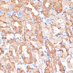Invitrogen NHLRC1 Polyclonal Antibody 100 &mu;L; Unconjugated:Antibodies,