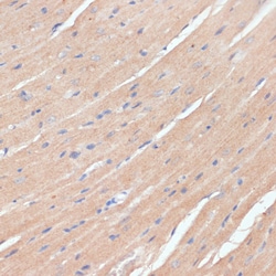 Invitrogen NHLRC1 Polyclonal Antibody 100 &mu;L; Unconjugated:Antibodies,