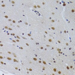 Invitrogen PPP1R8 Polyclonal Antibody 100 &mu;L; Unconjugated:Antibodies,