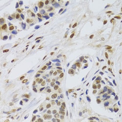 Invitrogen PPP1R8 Polyclonal Antibody 100 &mu;L; Unconjugated:Antibodies,