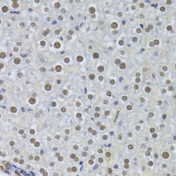 Invitrogen PPP1R8 Polyclonal Antibody 100 &mu;L; Unconjugated:Antibodies,