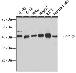 Invitrogen PPP1R8 Polyclonal Antibody 100 &mu;L; Unconjugated:Antibodies,