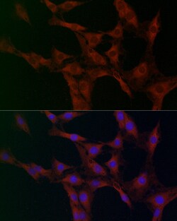 GOT2 Polyclonal Antibody:Antibodies, Polyclonal