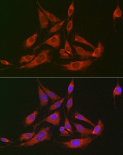 GOT2 Polyclonal Antibody:Antibodies, Polyclonal