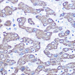 GOT2 Polyclonal Antibody:Antibodies, Polyclonal