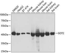 GOT2 Polyclonal Antibody:Antibodies, Polyclonal