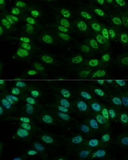 hnRNP M Polyclonal Antibody:Antibodies, Polyclonal