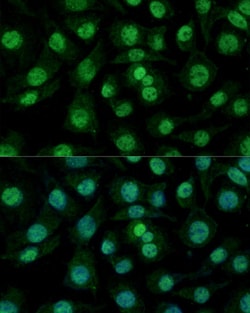 hnRNP M Polyclonal Antibody:Antibodies, Polyclonal