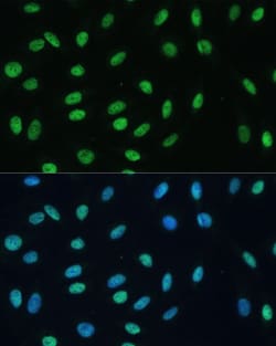 hnRNP M Polyclonal Antibody:Antibodies, Polyclonal