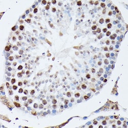 hnRNP M Polyclonal Antibody:Antibodies, Polyclonal