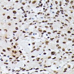 hnRNP M Polyclonal Antibody:Antibodies, Polyclonal
