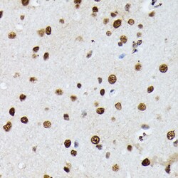 hnRNP M Polyclonal Antibody:Antibodies, Polyclonal