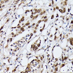 hnRNP M Polyclonal Antibody:Antibodies, Polyclonal
