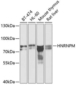 hnRNP M Polyclonal Antibody:Antibodies, Polyclonal