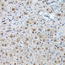 Invitrogen PFKFB3 Polyclonal Antibody 100 &mu;L; Unconjugated:Antibodies,
