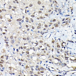 Invitrogen PFKFB3 Polyclonal Antibody 100 &mu;L; Unconjugated:Antibodies,