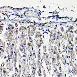 Invitrogen PFKFB3 Polyclonal Antibody 100 &mu;L; Unconjugated:Antibodies,