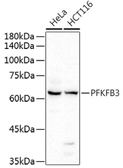 Invitrogen PFKFB3 Polyclonal Antibody 100 &mu;L; Unconjugated:Antibodies,
