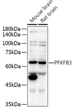 Invitrogen PFKFB3 Polyclonal Antibody 100 &mu;L; Unconjugated:Antibodies,