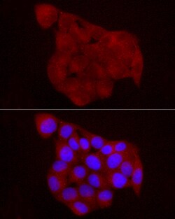 Invitrogen Chemerin Polyclonal Antibody 100 &mu;L; Unconjugated:Antibodies,