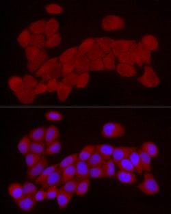 Invitrogen Chemerin Polyclonal Antibody 100 &mu;L; Unconjugated:Antibodies,