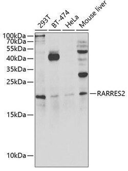 Invitrogen Chemerin Polyclonal Antibody 100 &mu;L; Unconjugated:Antibodies,