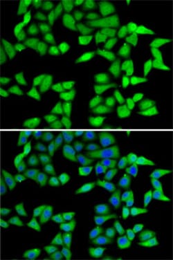 Invitrogen RBBP5 Polyclonal Antibody 100 μL; Unconjugated:Antibodies,