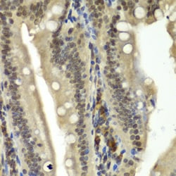 Invitrogen RBBP5 Polyclonal Antibody 100 μL; Unconjugated:Antibodies,